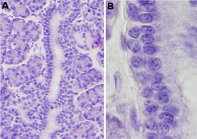 Epitelio estratificado cúbico 