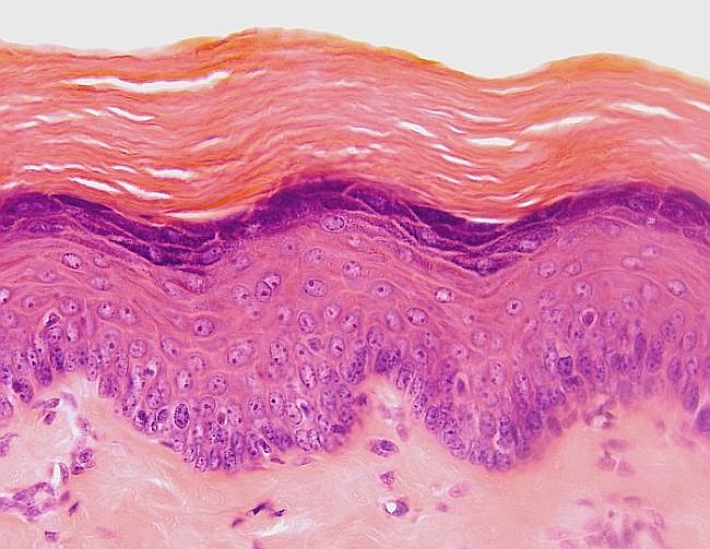 Epitelio Estratificado Plano Queratinizado Pdf