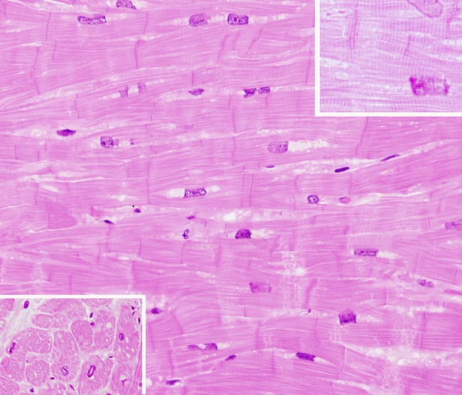 animal muscle tissue