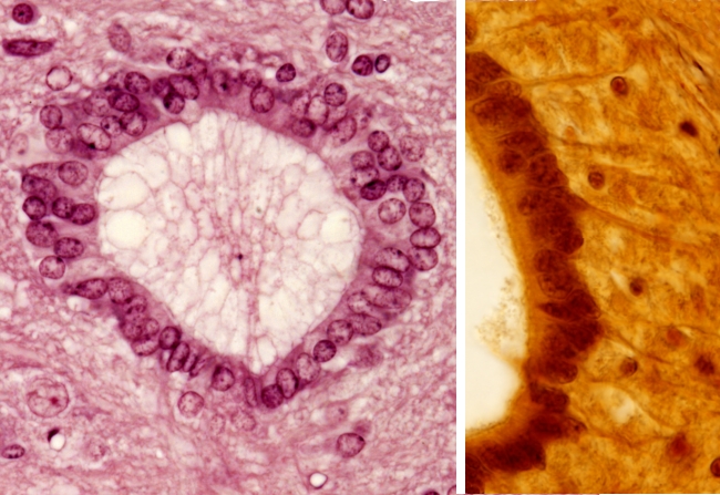 ependymal cells histology