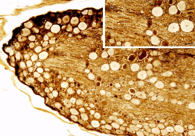 Spinal ganglia