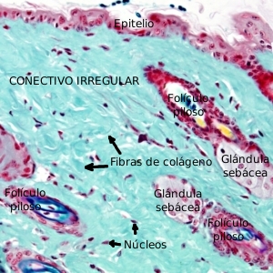 Conectivo irregular