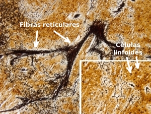 Conectivo reticular