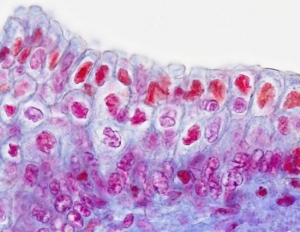 epitelio estratificado prismático